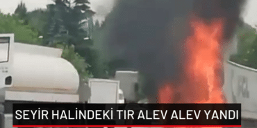 manşet (15)