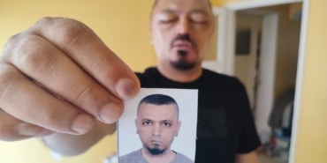SAÇLARINI SİYAHLATMAK İÇİN ALDIĞI ŞAMPUAN ARI SOKMASINDAN BETER HALE GETİRDİ YÜZÜ VE GÖZÜ ŞİŞEN MURAT GÖZDE: "GÖZLERİMİ KAYBEDECEĞİM DİYE ÇOK KORKTUM"