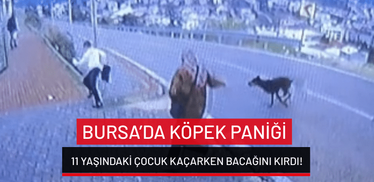 Bursa’da köpek paniği: 11 yaşındaki çocuk kaçarken bacağını kırdı!